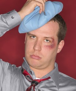 Man with black eye and ice pack